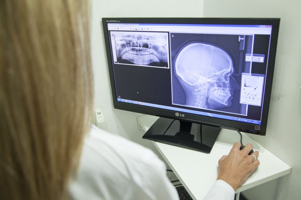 x-ray of the jaw, jaw, dentistry