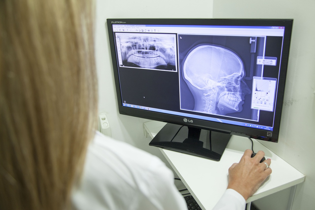 x-ray of the jaw, jaw, dentistry